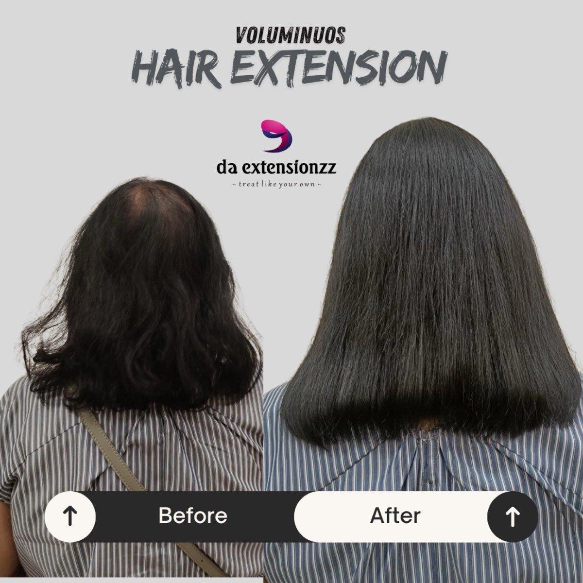 Before and after hair extensions fitted at DA Extensionzz, Chennai