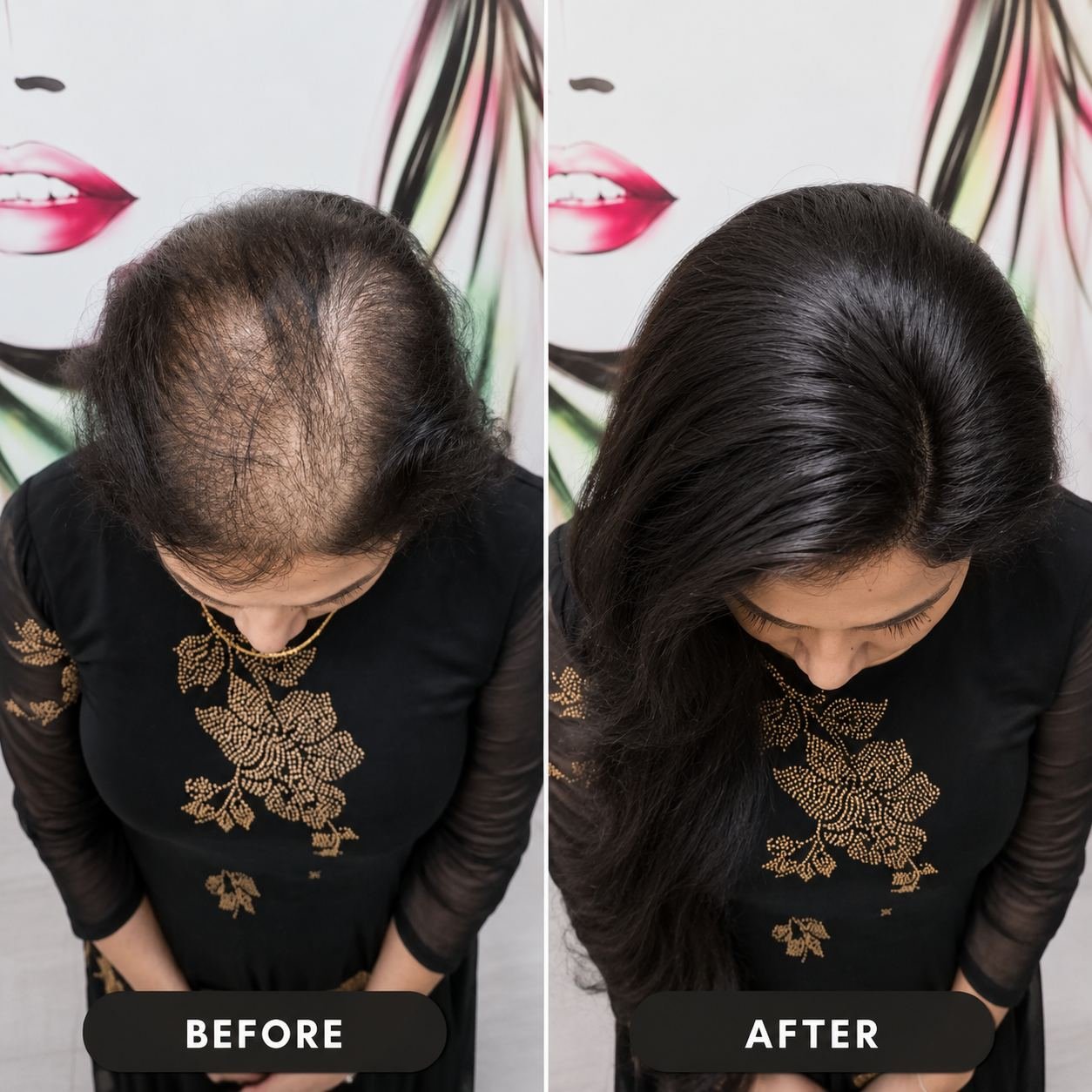 Before and after hair transformation 4 at DA Extensionzz Chennai